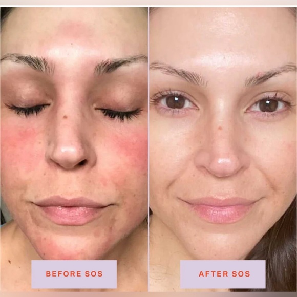 New SOS Tower 28 Daily Rescue Facial Spray - Spray Protecteur for Skin Flare-Ups - Picture 2 of 13